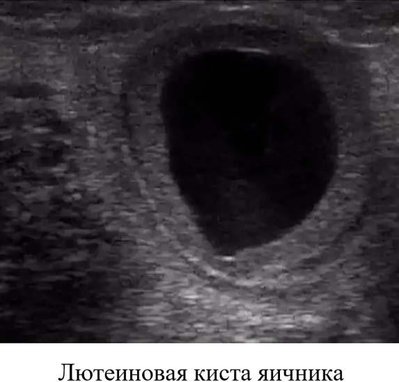 новсть нита2.jpg